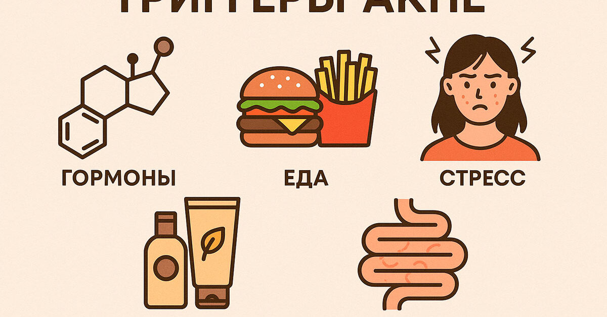 Причины акне на лице