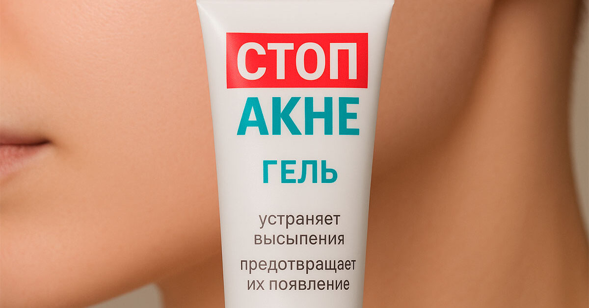 Стоп акне гель