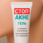 Стоп акне гель