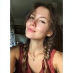 Закрытые комедоны и «перебор кислот»