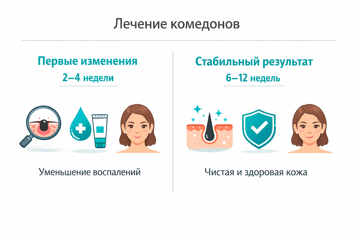 Сроки и ожидания результата